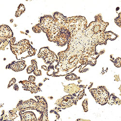 sars-cov-2 gene expression in a human fetus